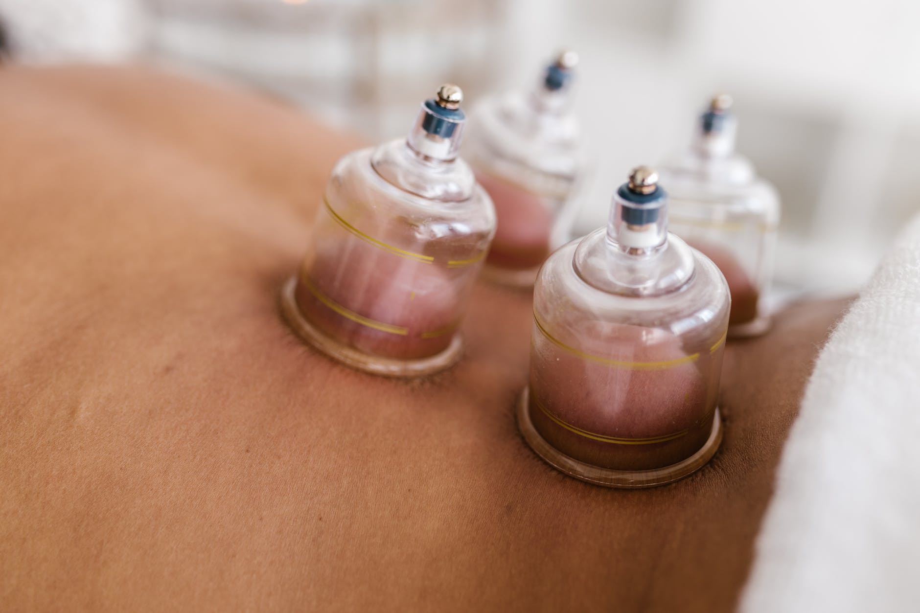 close up shot of a cupping therapy